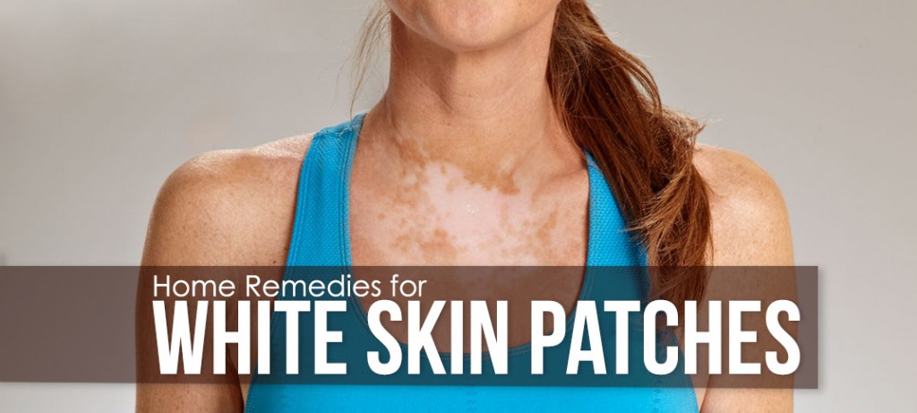 dry-skin-patches-causes-symptoms-diagnosis-and-treatments